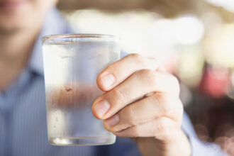efek minum air es, wasir